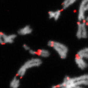 Les chromosomes (en gris) avec des cassures au niveau des centromères (en rouge) suite à des altérations des dynamiques de réplication de l’ADN. 