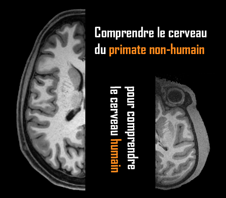 IRM de cerveau humain et de cerveau de primate non-humain