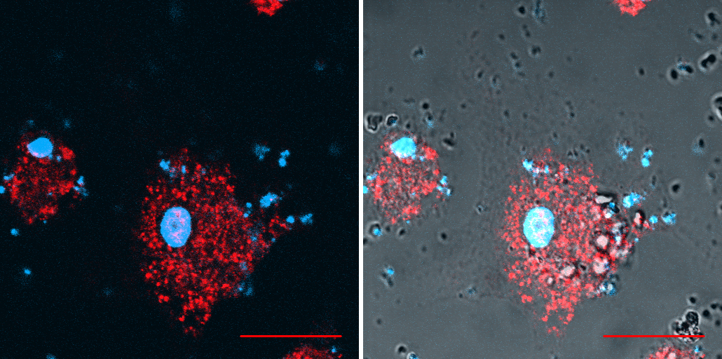 cellules vue en microscopie de fluorescence