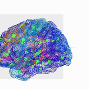 A virtual brain helps decrypt epilepsy