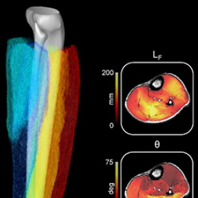 L'architecture des muscles explorée par IRM à très haut champ