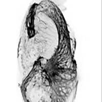 Vignette illustrant cette actualité