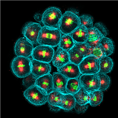 Vignette illustrant cette actualité