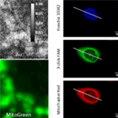Vignette illustrant cette actualité