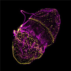 Vignette illustrant cette actualité