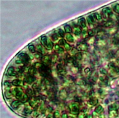 Vignette illustrant cette actualité