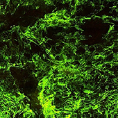 Vignette illustrant cette actualité