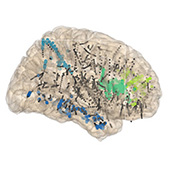 Vignette illustrant cette actualité