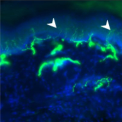 Vignette illustrant cette actualité