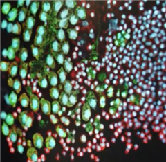 Vignette illustrant cette actualité