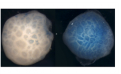 Vignette illustrant cette actualité