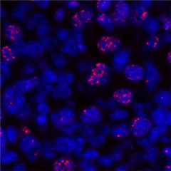 Vignette illustrant cette actualité