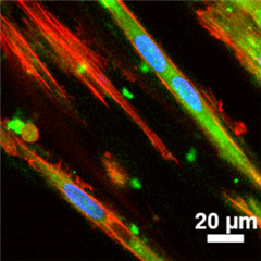 Vignette illustrant cette actualité