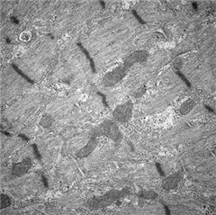 Vignette illustrant cette actualité