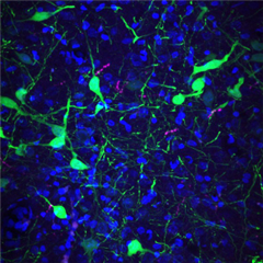 Vignette illustrant cette actualité