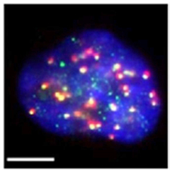 Vignette illustrant cette actualité