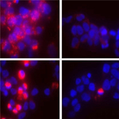 Vignette illustrant cette actualité