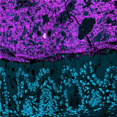 Vignette illustrant cette actualité