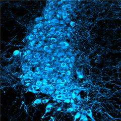 Vignette illustrant cette actualité