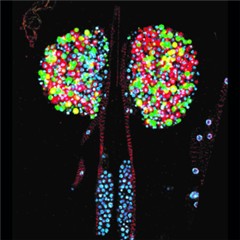 Vignette illustrant cette actualité