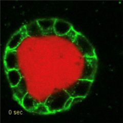 Vignette illustrant cette actualité