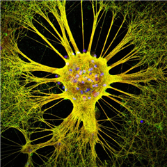 Vignette illustrant cette actualité