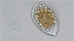 Vignette illustrant cette actualité