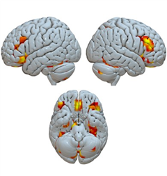 Vignette illustrant cette actualité