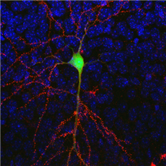 Vignette illustrant cette actualité