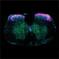 Vignette illustrant cette actualité