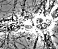 Vignette illustrant cette actualité