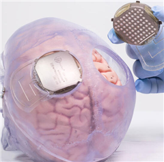 Vignette illustrant cette actualité