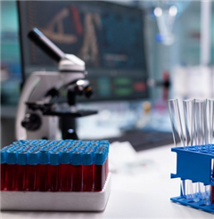 Vignette illustrant cette actualité