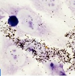 Vignette illustrant cette actualité