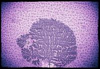 Vignette illustrant cette actualité