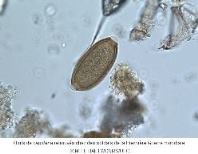 Vignette illustrant cette actualité