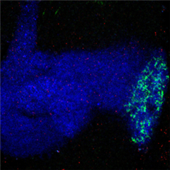 Vignette illustrant cette actualité