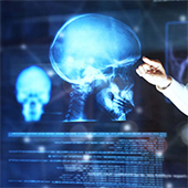 Vignette illustrant cette actualité