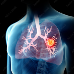 Vignette illustrant cette actualité