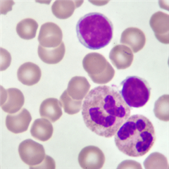 Vignette illustrant cette actualité