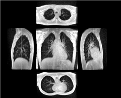 Vignette illustrant cette actualité