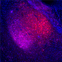 Vignette illustrant cette actualité