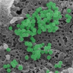 Vignette illustrant cette actualité