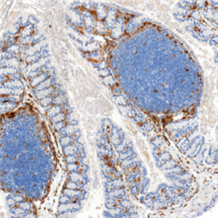 Vignette illustrant cette actualité