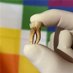 Vignette illustrant cette actualité