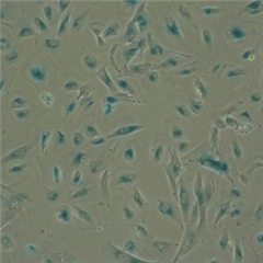 Vignette illustrant cette actualité