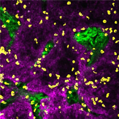 Vignette illustrant cette actualité