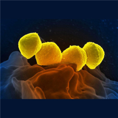 Vignette illustrant cette actualité