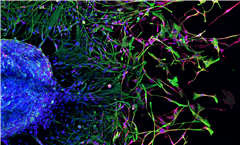 Vignette illustrant cette actualité