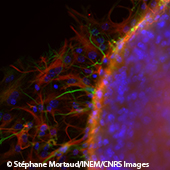 Vignette illustrant cette actualité